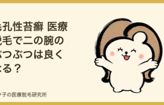 毛孔性苔癬 医療脱毛で二の腕のぶつぶつは良くなる？サメ肌への効果と注意点